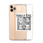 iPHONE CASE ALBUM ART - WHITE